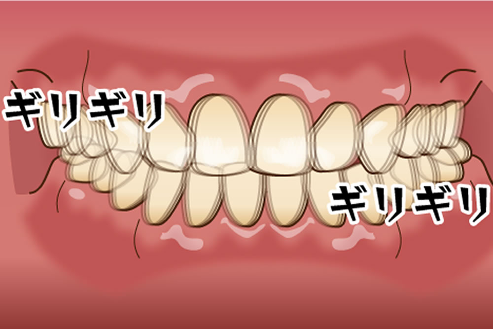 サンプルイメージ