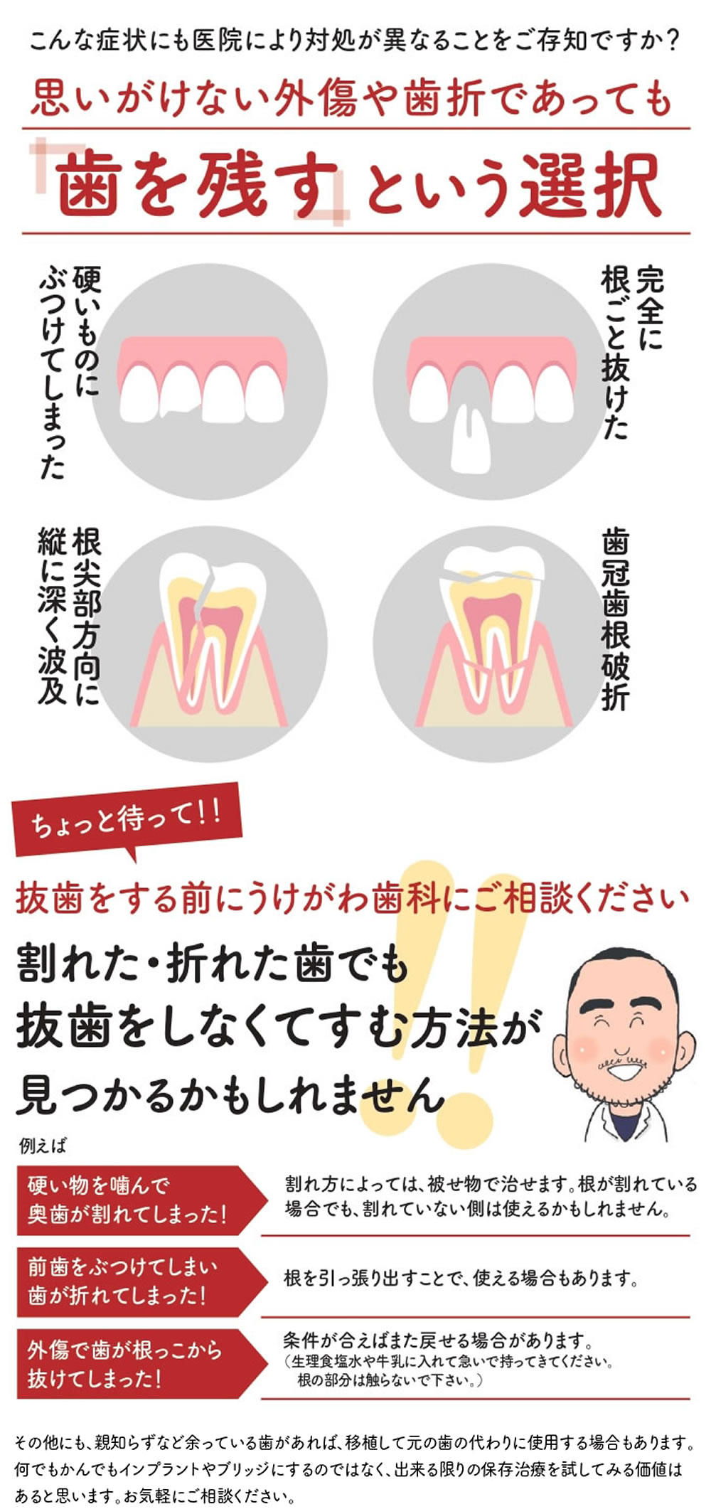 外傷歯や歯根破折の抜歯回避