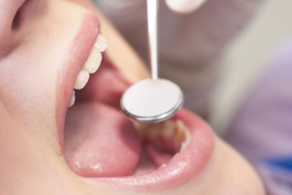 虫歯・歯周病の治療
